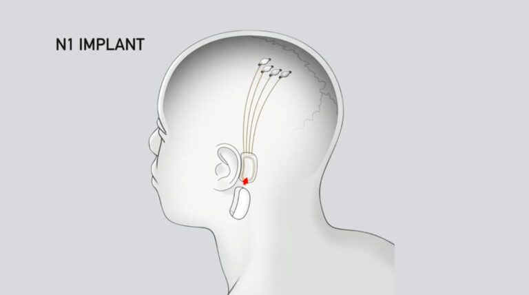تراشه مغزی نورالینک در شرف اولین تست انسانی
