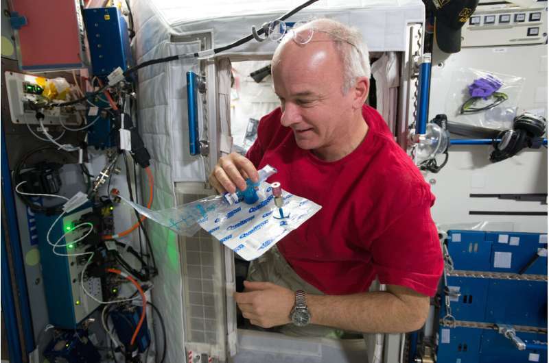 کم خونی فضانوردان