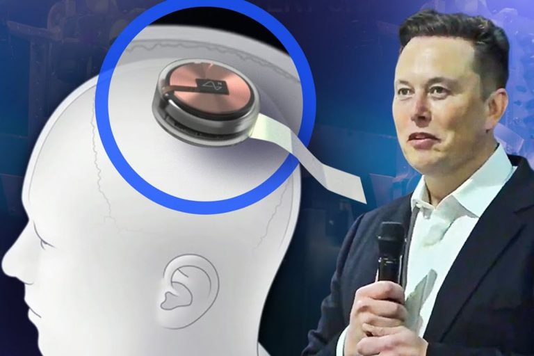 هر آنچه باید در مورد تراشه مغزی شرکت نورالینک بدانید