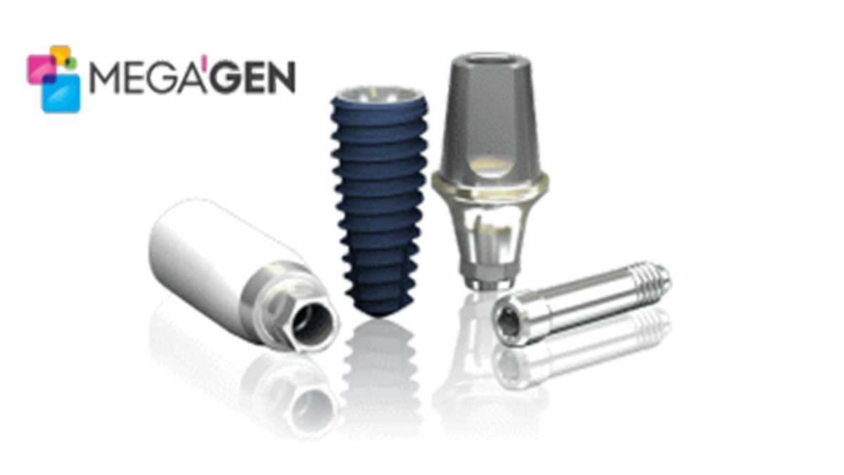 ایمپلنت کره ای مگاژن در مرکز ایمپلنت