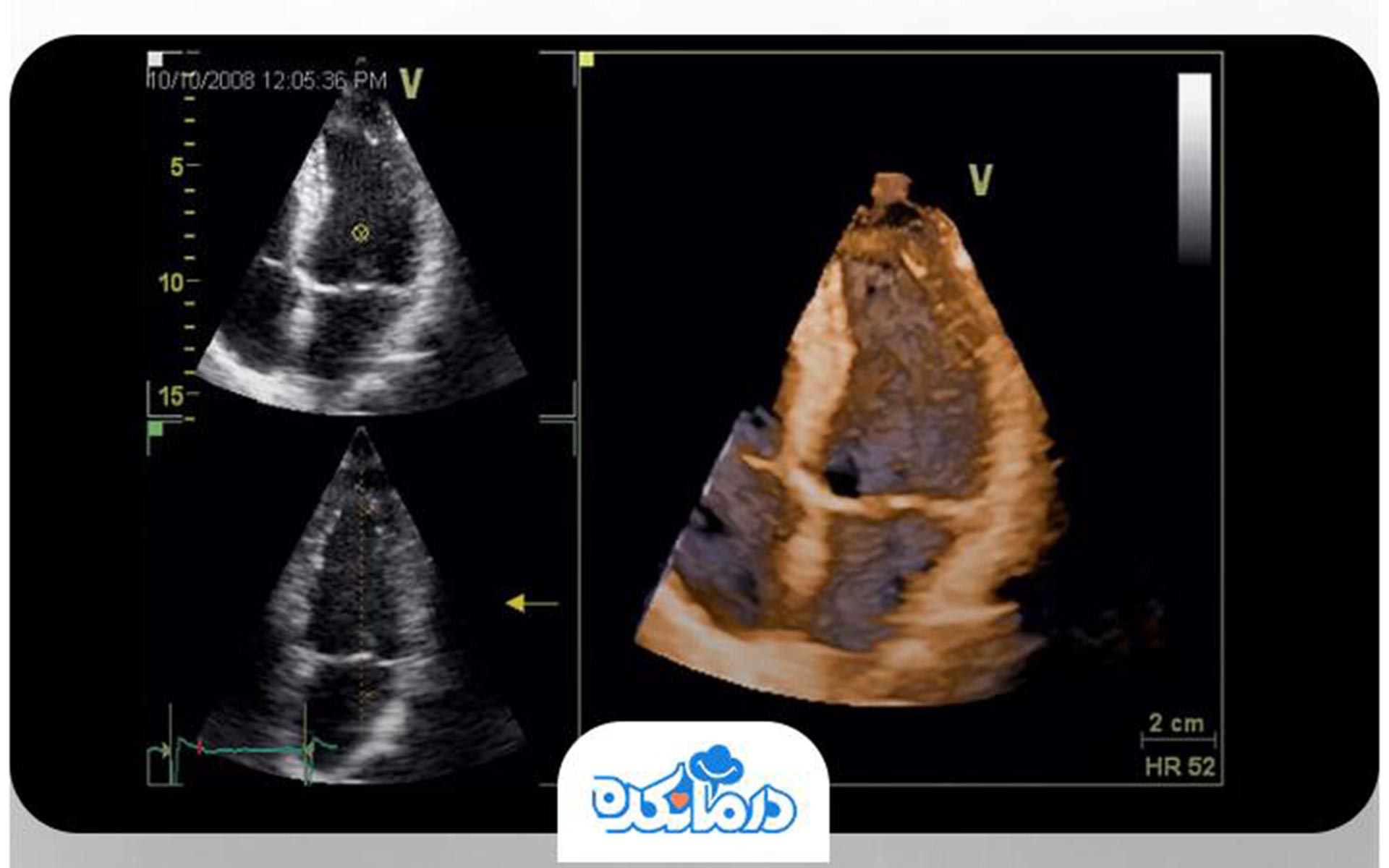 درمانکده از سلامت قلب شما خبر میدهد
