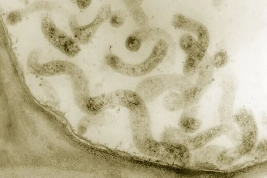 عکس | کوچکترین شکل حیات به حرکت درآمد