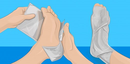 پاهای خود را با فویل آلومینیومی بپیچید و چند ساعت بعد، نتیجه خارقالعادهاست!
