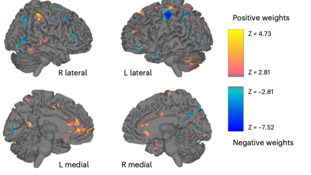 کلید درمان انواع اعتیاد در مغز پیدا شد / عکس