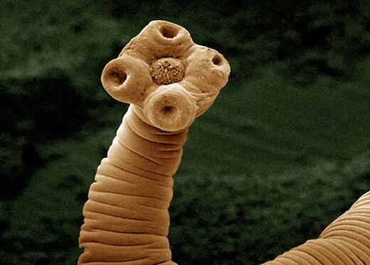 چرا نباید از نابودی انگل‌ها خوشحال شویم؟