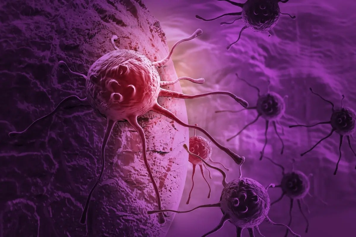 قدیمیترین مورد شناختهشده سرطان در انسان متعلق به چه زمانی
است؟