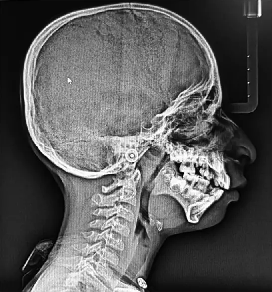 خانواده مارمولکی؛ خانواده اسیر سندرومی ویرانگر و منحصر به فرد!/ عکس