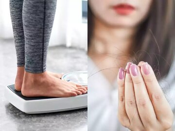چه ارتباطی بین کاهش وزن و ریزش مو وجود دارد؟