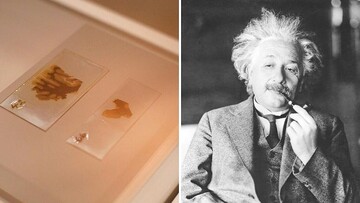 بلایی که پس از مرگ سر مغز اینشتین آوردند/ عکس