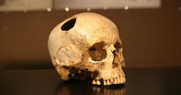 پیدا شدن جمجمهای استثنایی در چین/ دانش حیرتانگیز مردم سه هزار سال پیش/ عکس