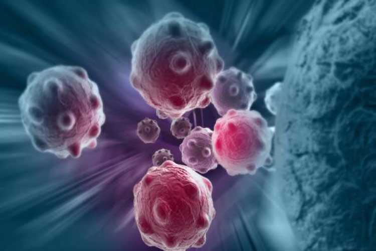 کلسیم کلید درمان سرطان است