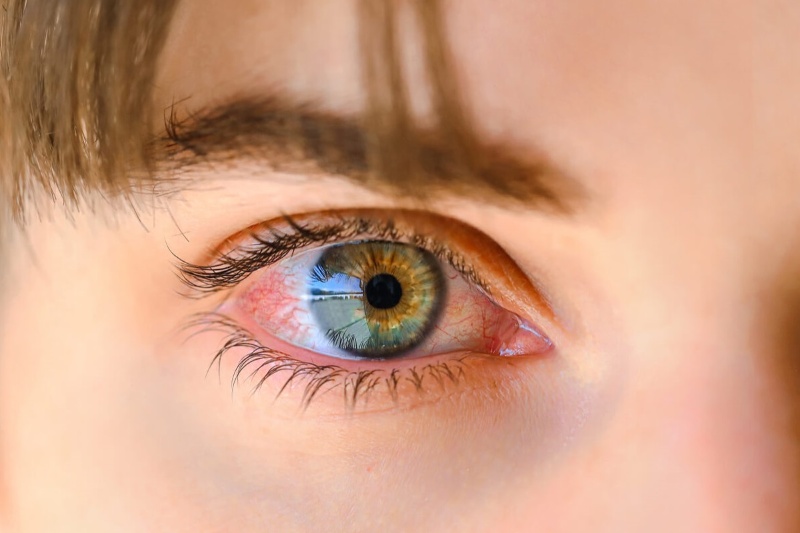 پلکزدن در واقع بینایی ما را تقویت میکند