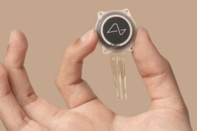 اولین دریافت کننده تراشه مغزی چگونه زندگی می‌کند؟