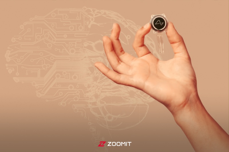 تراشه جنجالی ایلان ماسک بهزودی وارد مغز دومین بیمار میشود