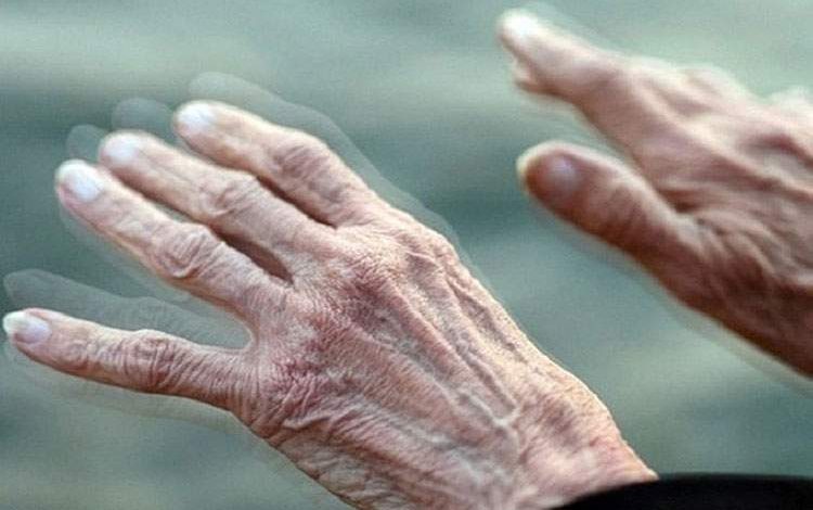 هوش مصنوعی به کمک تشخیص پارکینسون میآید