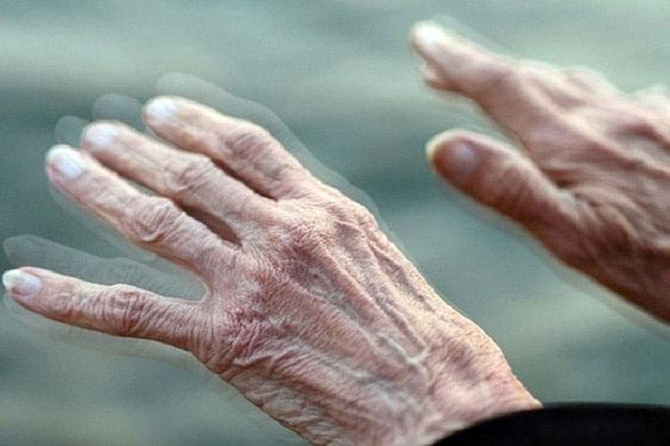 هوش مصنوعی به کمک تشخیص پارکینسون می‌آید