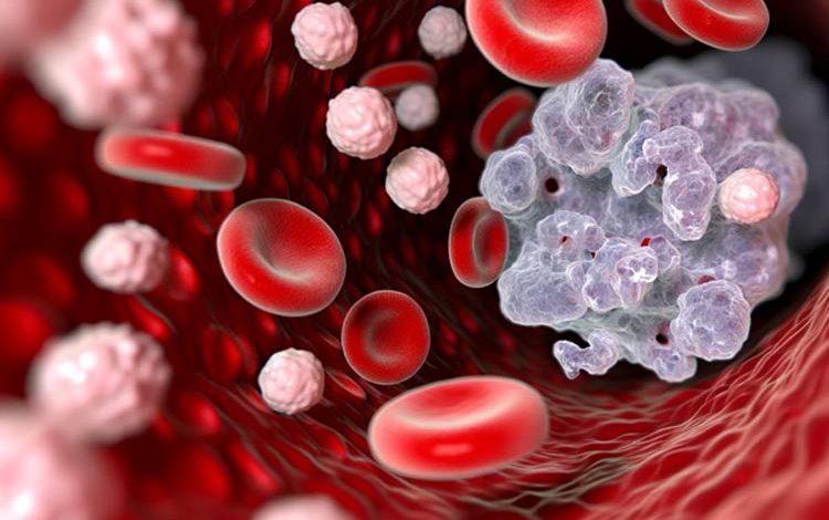 نیمی از مرگومیرهای ناشی از سرطان با ایجاد تغییر در سبکزندگی قابل پیشگیری است