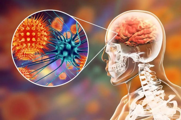 ویروسی شایع میتواند عامل نوعی آلزایمر باشد