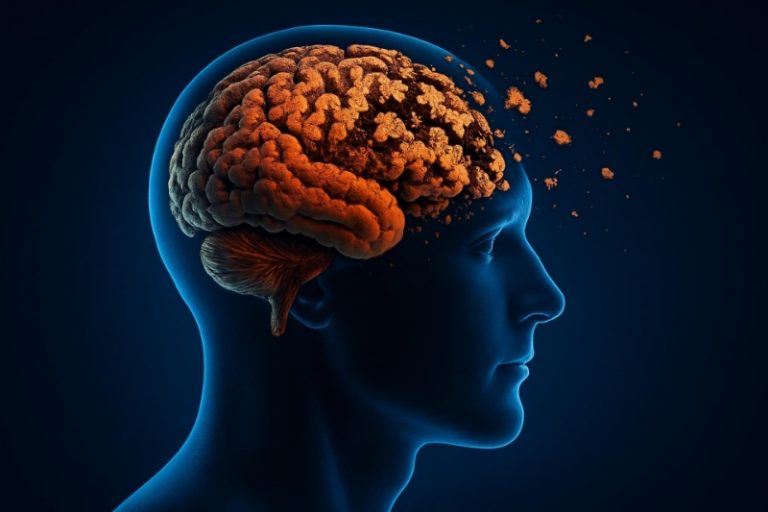 فقط ۱۰ روز بی‌تحرکی مغز را در مسیر آلزایمر قرار می‌دهد