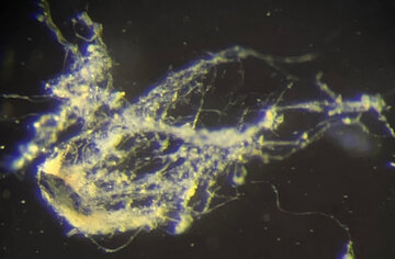 کشف شگفت‌انگیز موجودی که همانند سیم برق زنده است