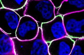 تشخیص سرطان با نور ممکن شد