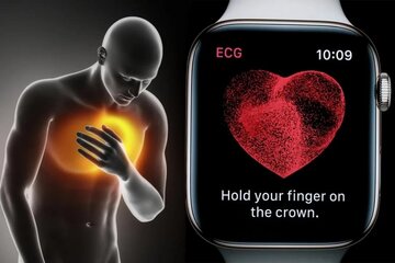 واردات اپل واچ دردسرساز شد