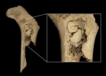 چرا انسان‌ها همنوع‌خواری می‌کردند؟