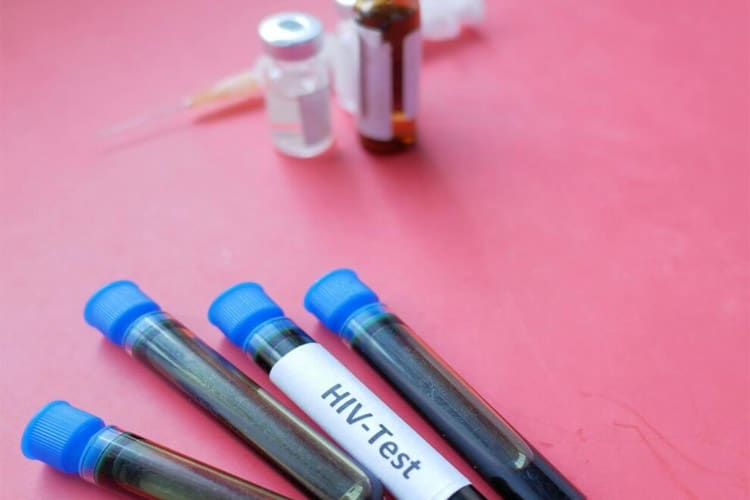 داروی پیشگیری از ایدز از دو سال دیگر عرضه می‌شود