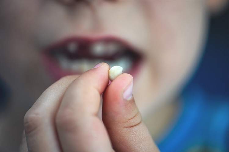 در هنگام ضربه به دندان شیری چه کارهایی باید انجام دهیم؟