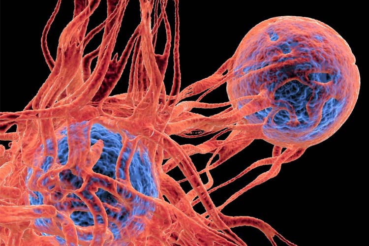 سلول‌های بنیادی مهندسی‌شده؛ سلاحی تازه علیه بازگشت سرطان در راه است