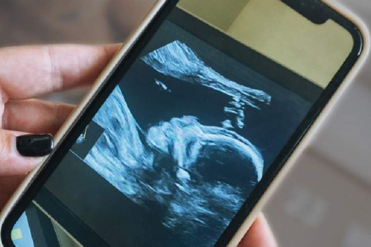 اضطراب می‌تواند ریشه در دوران جنینی داشته باشد