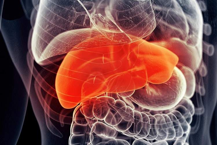 ترکیب دو داروی شناخته‌شده، رویکردی نو برای مقابله با بیماری کبد چرب