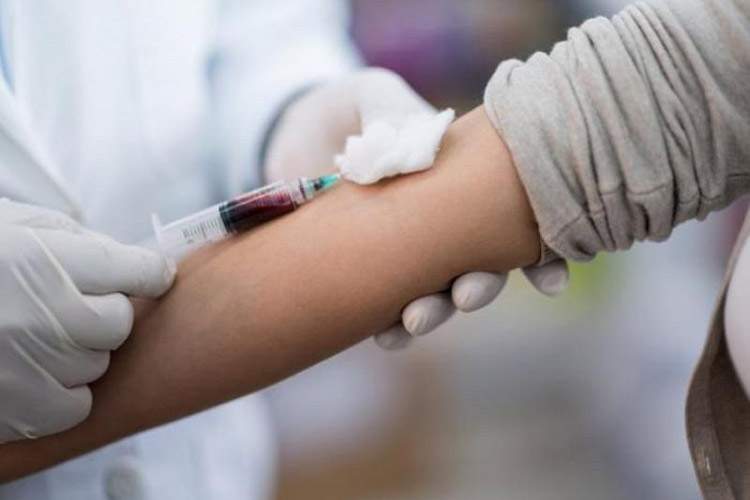 راز عمر طولانی: ۴ آزمایش خون ضروری پس از ۴۰ سالگی