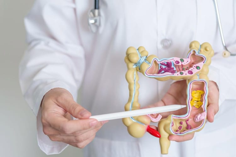 هفت نشانه اولیه سرطان روده بزرگ