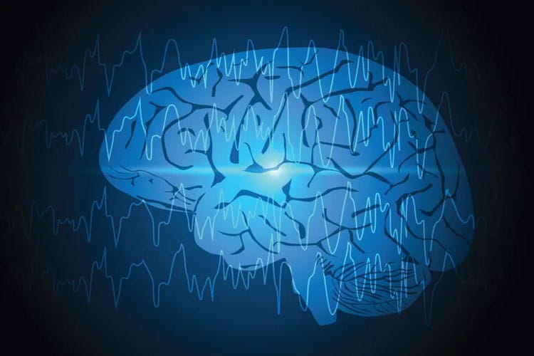 هوش مصنوعی و درمان صرع: شناسایی ضایعات پنهان مغز در کودکان