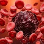 روش جدید نوردرمانی در نیم ساعت، ۹۰ درصد از سلول‌های سرطانی را از بین می‌برد