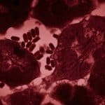 پیوند عضو مرگبار؛ اهداکننده کلیه ویروس هاری را به گیرنده منتقل کرد و جان او را گرفت