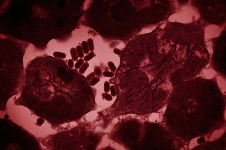 پیوند عضو مرگبار؛ اهداکننده کلیه ویروس هاری را به گیرنده منتقل کرد و جان او را گرفت