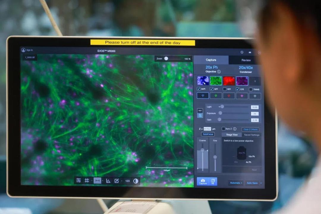 سلول‌های مغزی (Brain Cells) با رنگ‌های سبز و بنفش در نمایشگر میکروسکوپ