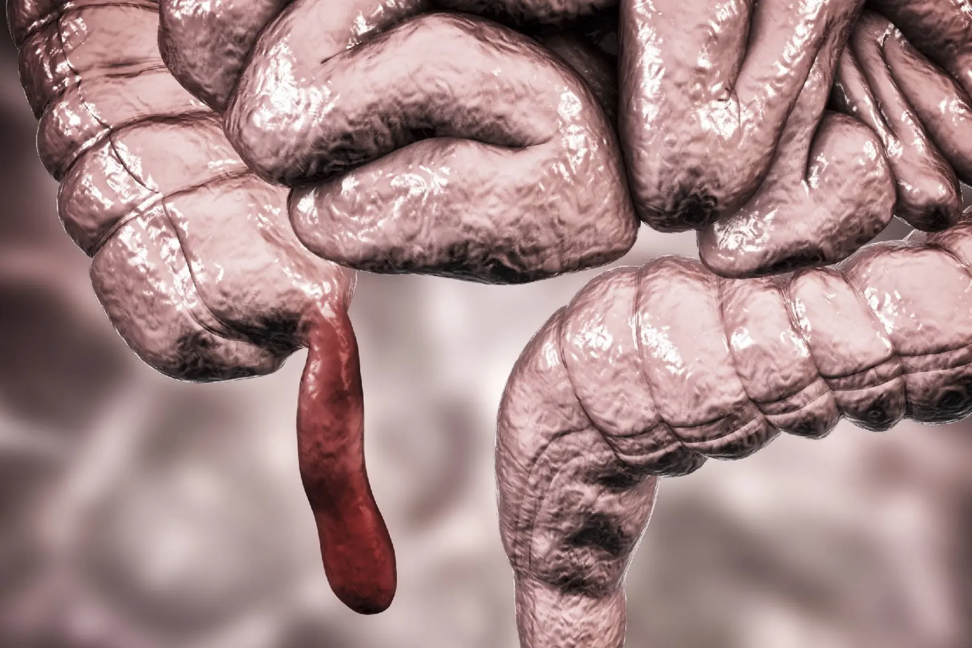 نقش پنهان آپاندیس؛ عضو ظاهراً بیفایده ما دستکم ۳۲ بار در تاریخ تکامل یافته است